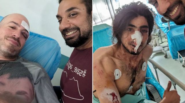 Πάρνηθα: Επτά οι δράστες της επίθεσης στους εθελοντές - Νέες φωτογραφίες από τους τραυματίες